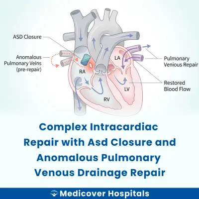 Complex Intracardiac Repair With Asd Closure and Anomalous Pulmonary Venous Drainage Repair