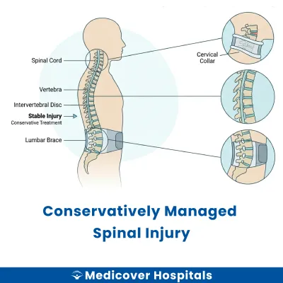 Conservatively Managed Spinal Injury
