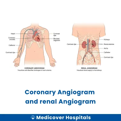 Coronary Angiogram and Renal Angiogram