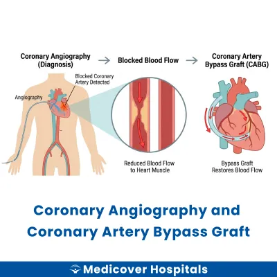 Coronary Angiography and Coronary Artery Bypass Graft