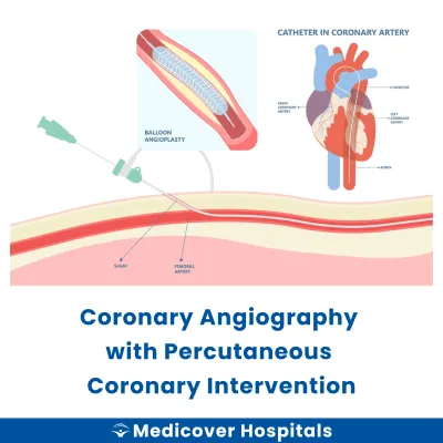 Coronary Angiography With Percutaneous Coronary Intervention