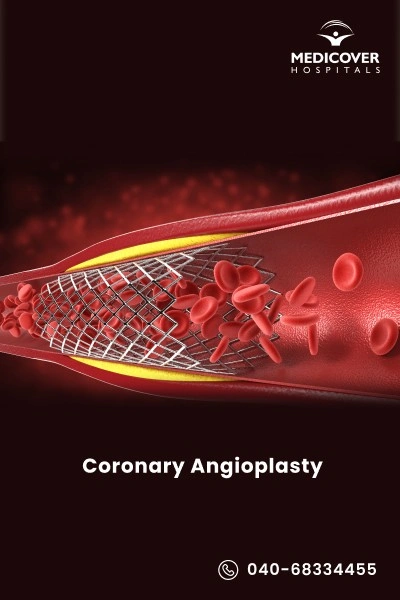 coronary-angioplasty-and-stents-insertion