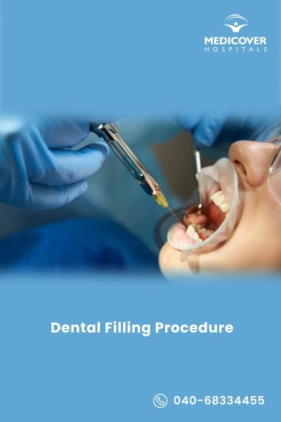 dental-fillings