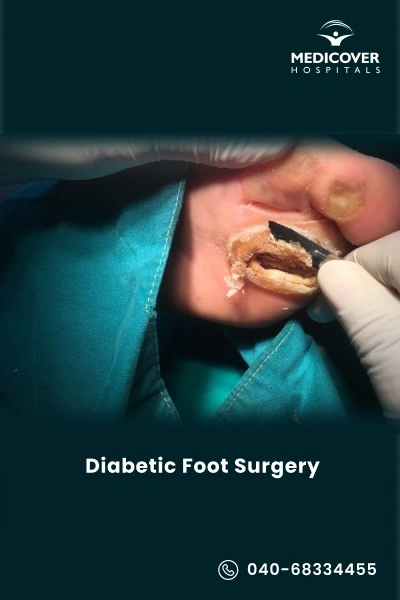 diabetic-foot