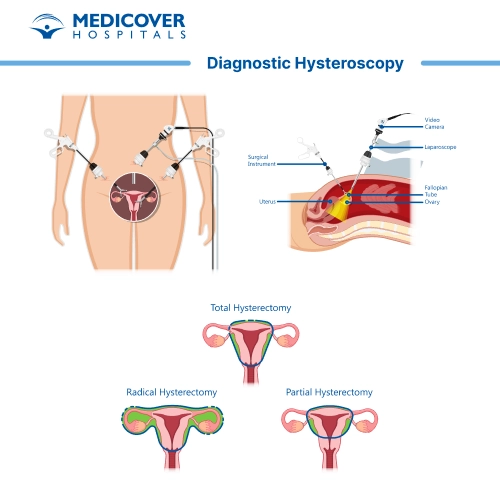 Diagnostic Hysteroscopy