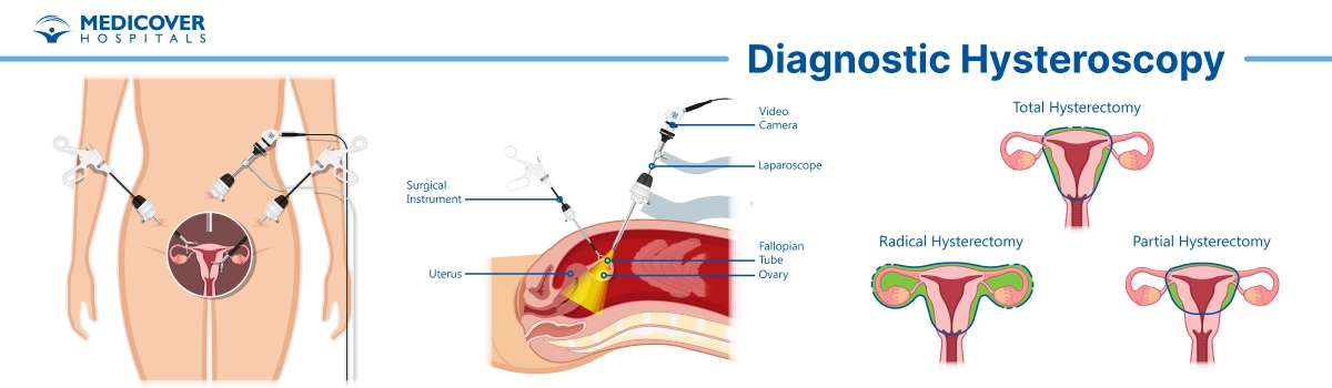 Diagnostic Hysteroscopy