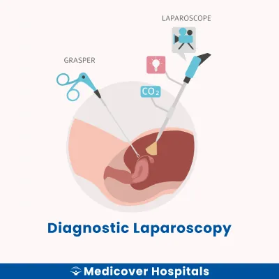 Diagnostic Laparoscopy