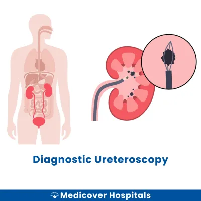Diagnostic Ureteroscopy
