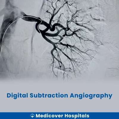 Digital Subtraction Angiography