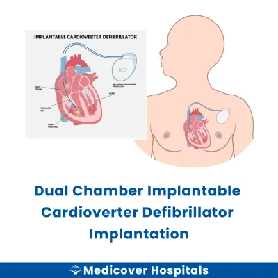 Dual Chamber Implantable Cardioverter Defibrillator Implantation