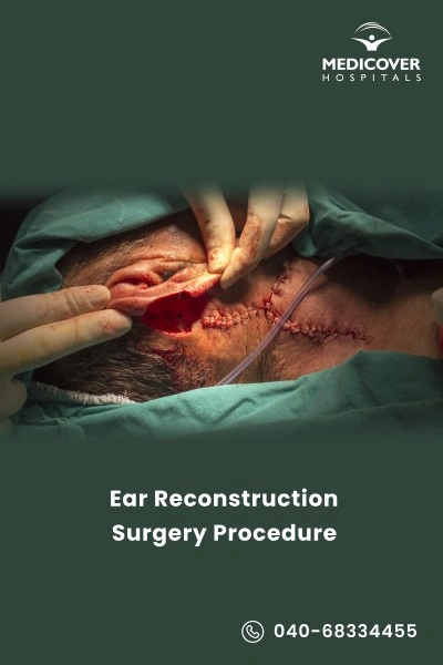 ear-reconstruction