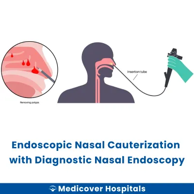 Endoscopic Nasal Cauterization With Diagnostic Nasal Endoscopy