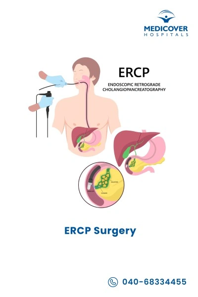 endoscopic-retrograde-cholangiopancreatography-ercp