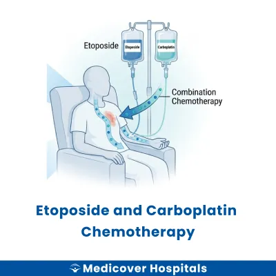 Etoposide and Carboplatin Chemotherapy
