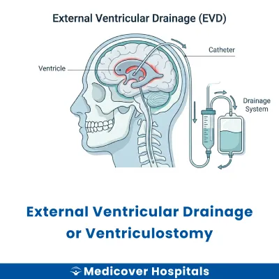 External Ventricular Drainage Or Ventriculostomy