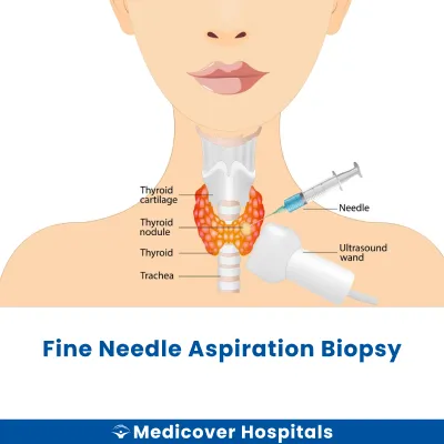 Fine Needle Aspiration Biopsy