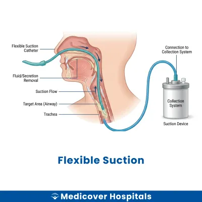 Flexible Suction