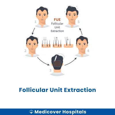 Follicular Unit Extraction