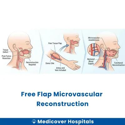 Free Flap Microvascular Reconstruction