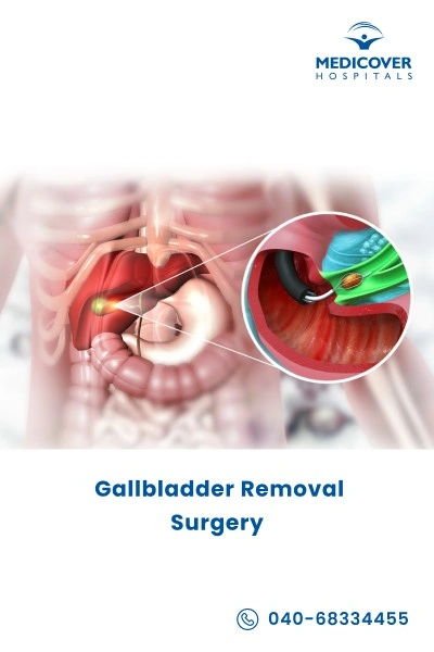 gallbladder-removal