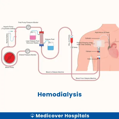 Haemodialysis