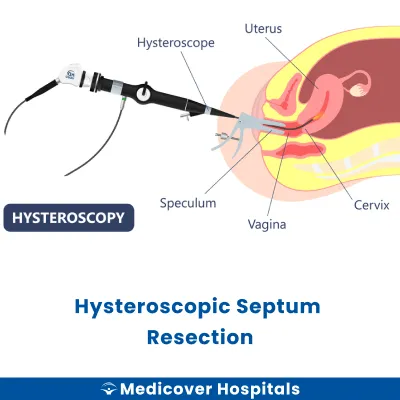 Hysteroscopic Septum Resection
