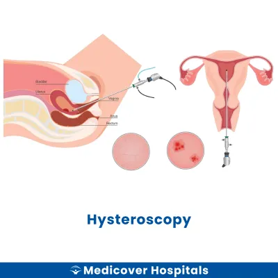Hysteroscopy