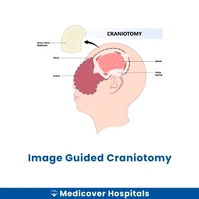 Image Guided Craniotomy