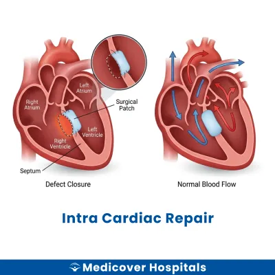 Intra Cardiac Repair