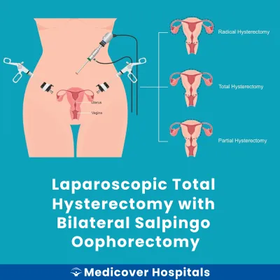 Laparoscopic Total Hysterectomy With Bilateral Salpingo Oophorectomy