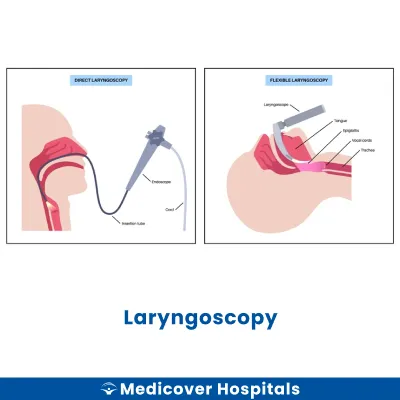 Laryngoscopy