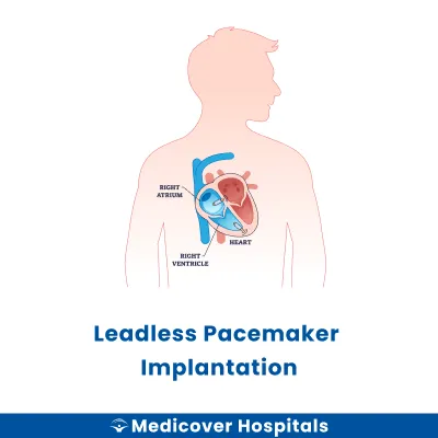 Leadless Pacemaker Implantation
