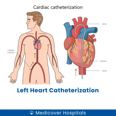Left Heart Catheterization