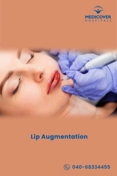 lip-augmentation