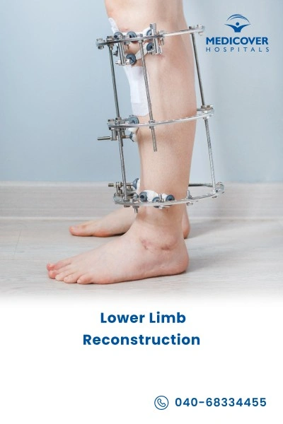 lower-limb-reconstruction