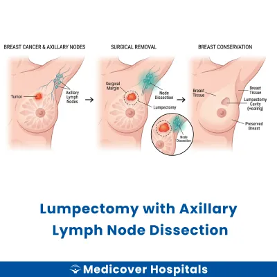 Lumpectomy With Axillary Lymph Node Dissection
