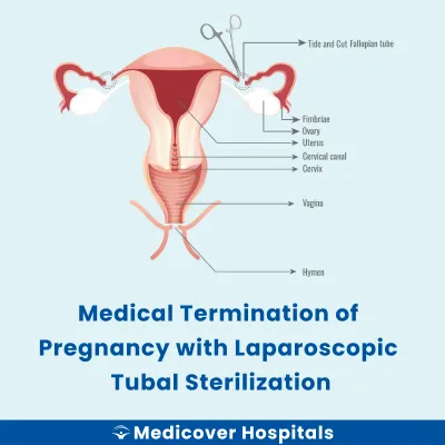 Medical Termination of Pregnancy With Laparoscopic Tubal Sterilization
