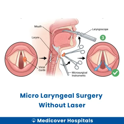 Micro Laryngeal Surgery Without Laser