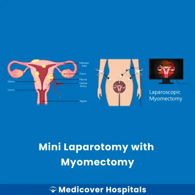 Mini Laparotomy With Myomectomy