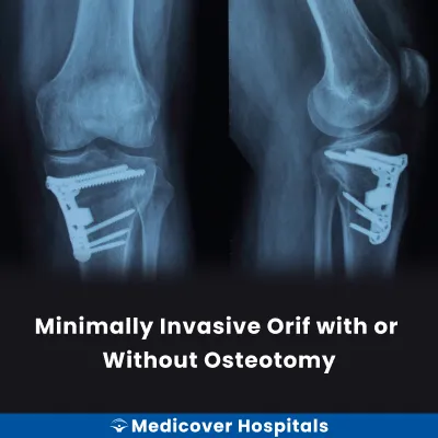 Minimally Invasive Orif With Or Without Osteotomy