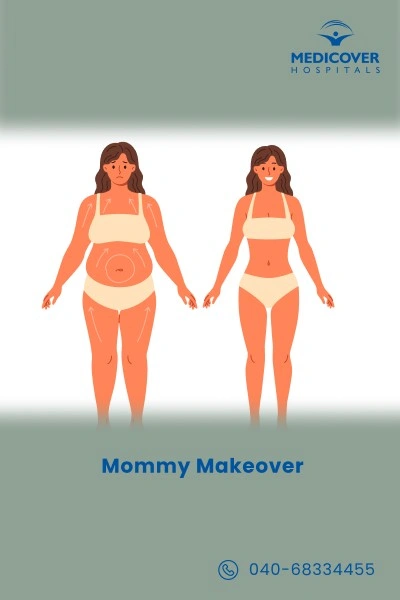 mommy-makeover