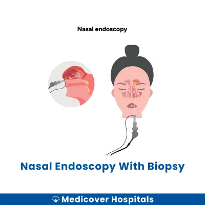 Nasal Endoscopy With Biopsy