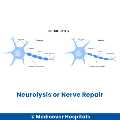Neurolysis Or Nerve Repair