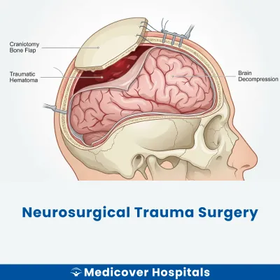 Neurosurgical Trauma Surgery