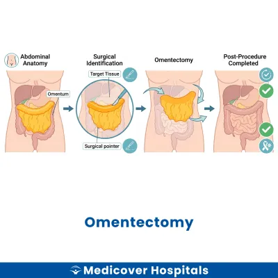 Omentectomy