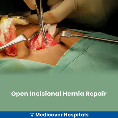 Open Incisional Hernia Repair