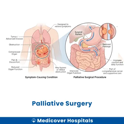 Palliative Surgery