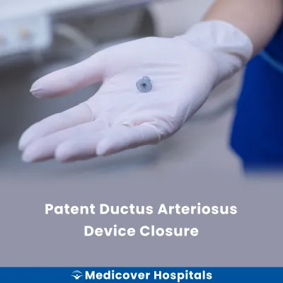Patent Ductus Arteriosus Device Closure