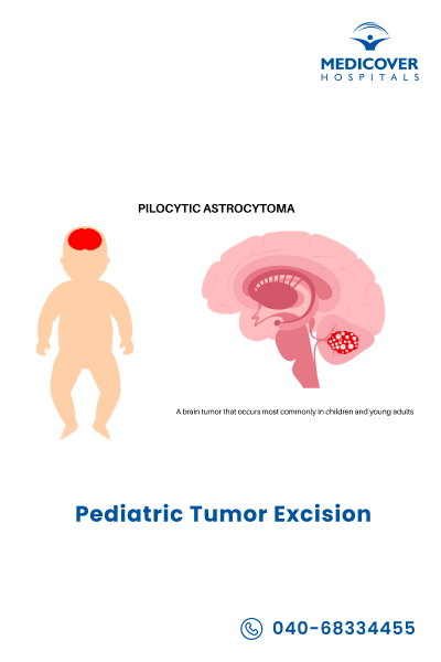 Pediatric Tumor Excision