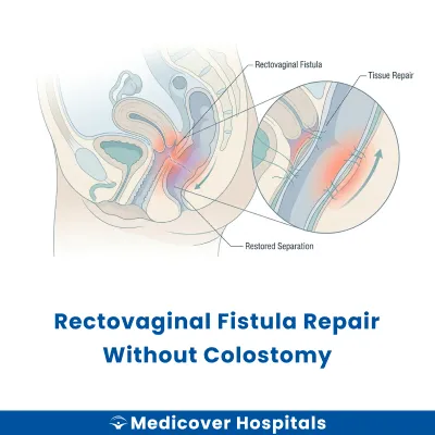 Rectovaginal Fistula Repair Without Colostomy